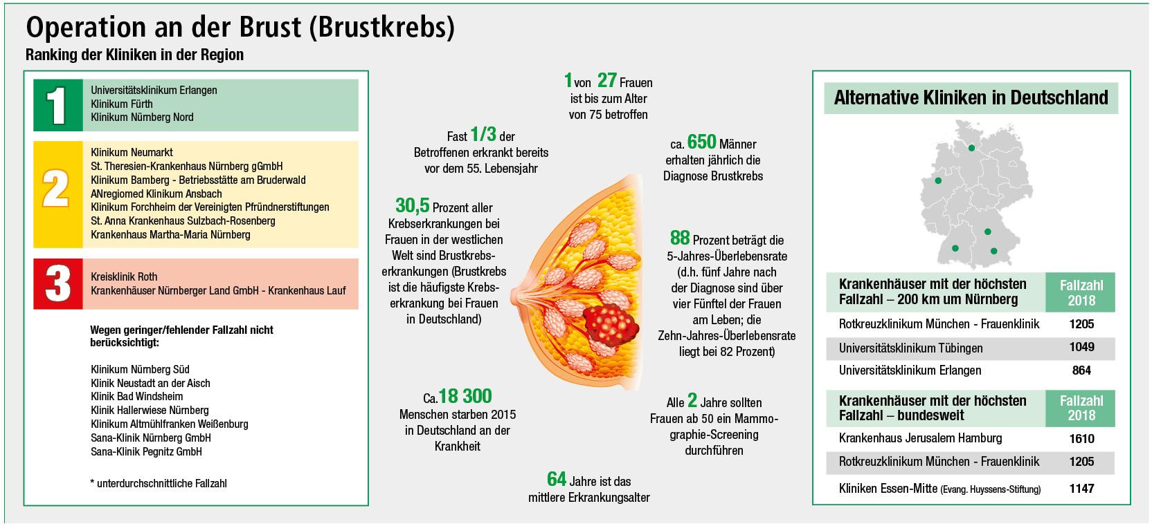 Brustkrebs Diese Klinik Ist Die Beste Anlaufstelle Erlangen Nordbayernde 